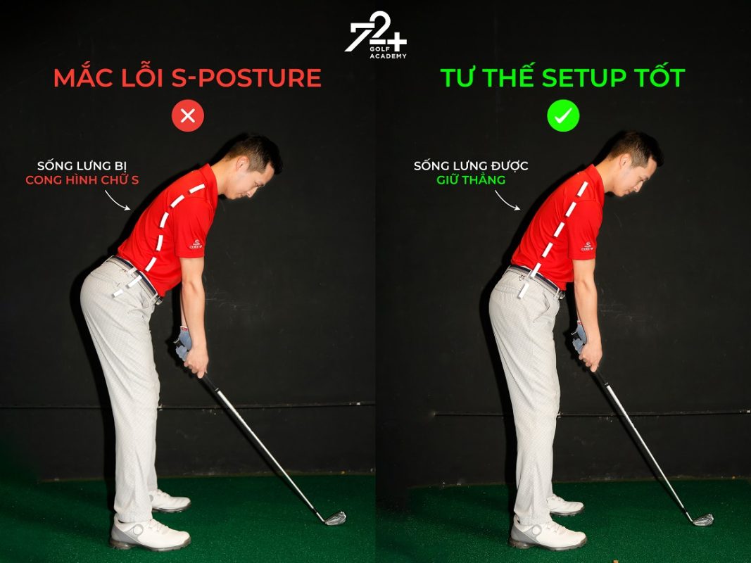 Khắc phục lỗi S-Posture và C-Posture